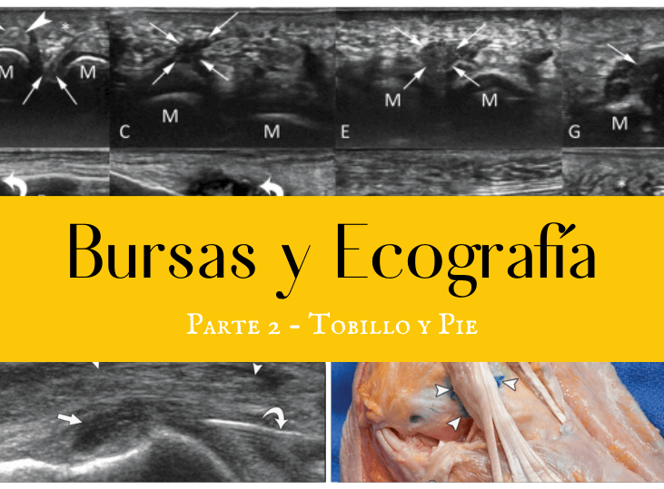 bursas-y-ecografia-parte-2-tobillo-y-pie